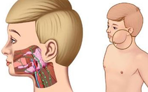 �����׵�����֢״ ��������ô����